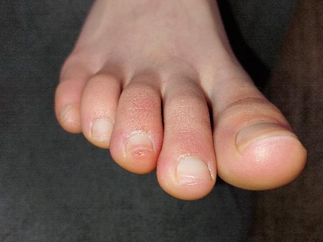 En hiver, nos pieds peuvent souffrir de la température, que faire pour les aider ?